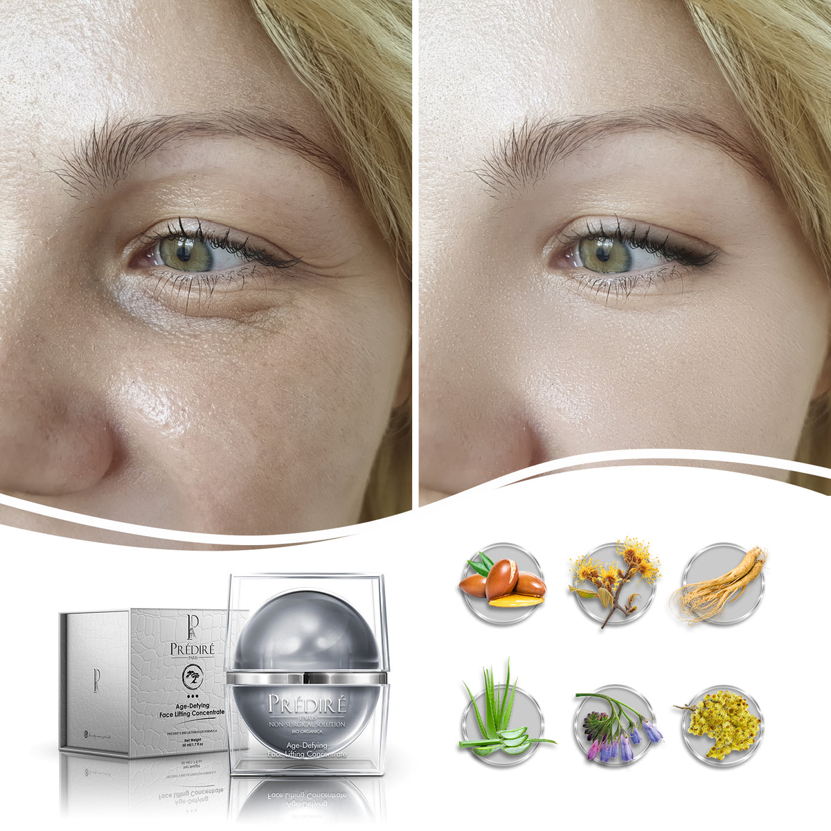AgeDefying Face Lifting Concentrate (a nonsurgical treatment), 50ml Prédiré Paris