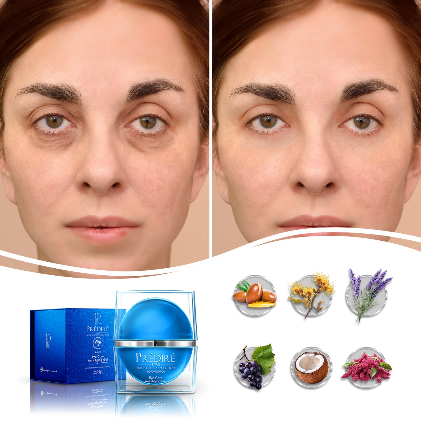 Intensive Rapid Renewal Eye Care Anti Aging Gel (Treats Puffiness and Dark Circles)