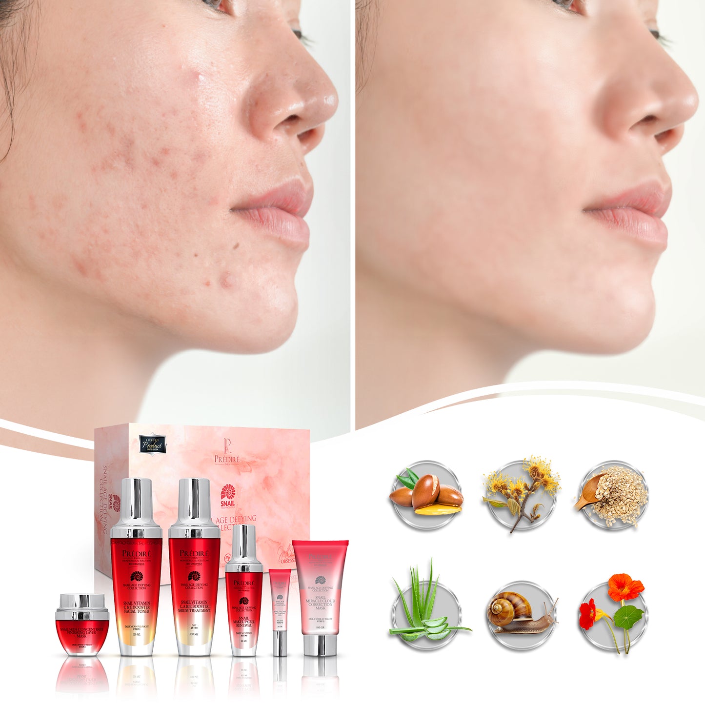 Snail Age-Defying Collection | Concentrate, Serum, Gel, Renewal, Mask, & Toner | Limited Edition