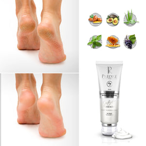 Intensive Foot & Hand Cream for Dry Skin & Rough Skin (Rich with Vitamin E)