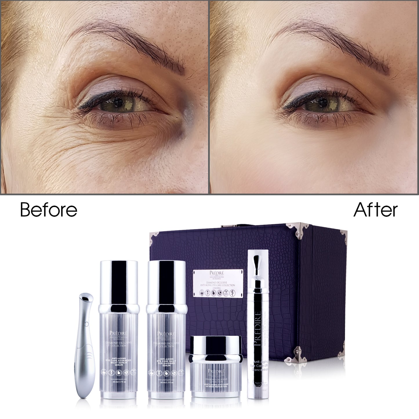 Diamond Exclusive Anti-Aging Eye Care Collection (Infused)