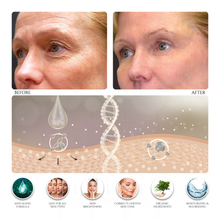 Skin Tightening & Tissue Bonding Serum (Treats Deep Wrinkles & Cellulite)