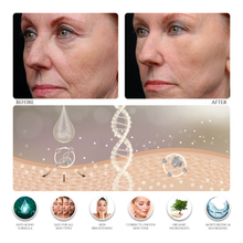 Skin Tightening & Tissue Bonding Mask (Treats Deep Wrinkles & Cellulite)